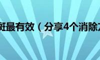 怎样去斑最有效（分享4个消除方法）